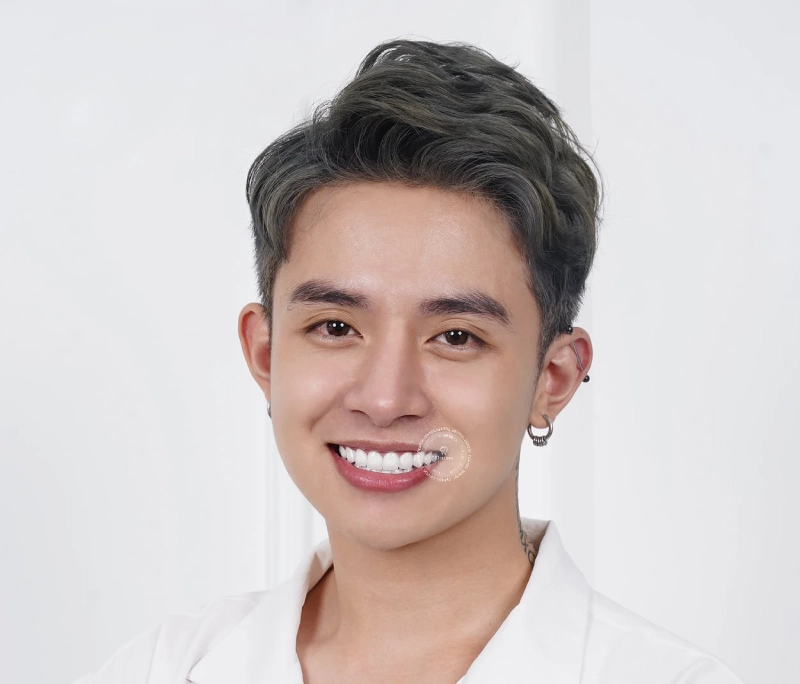 Làm răng sứ có tốt không? Nên bọc loại nào tốt nhất 2025?